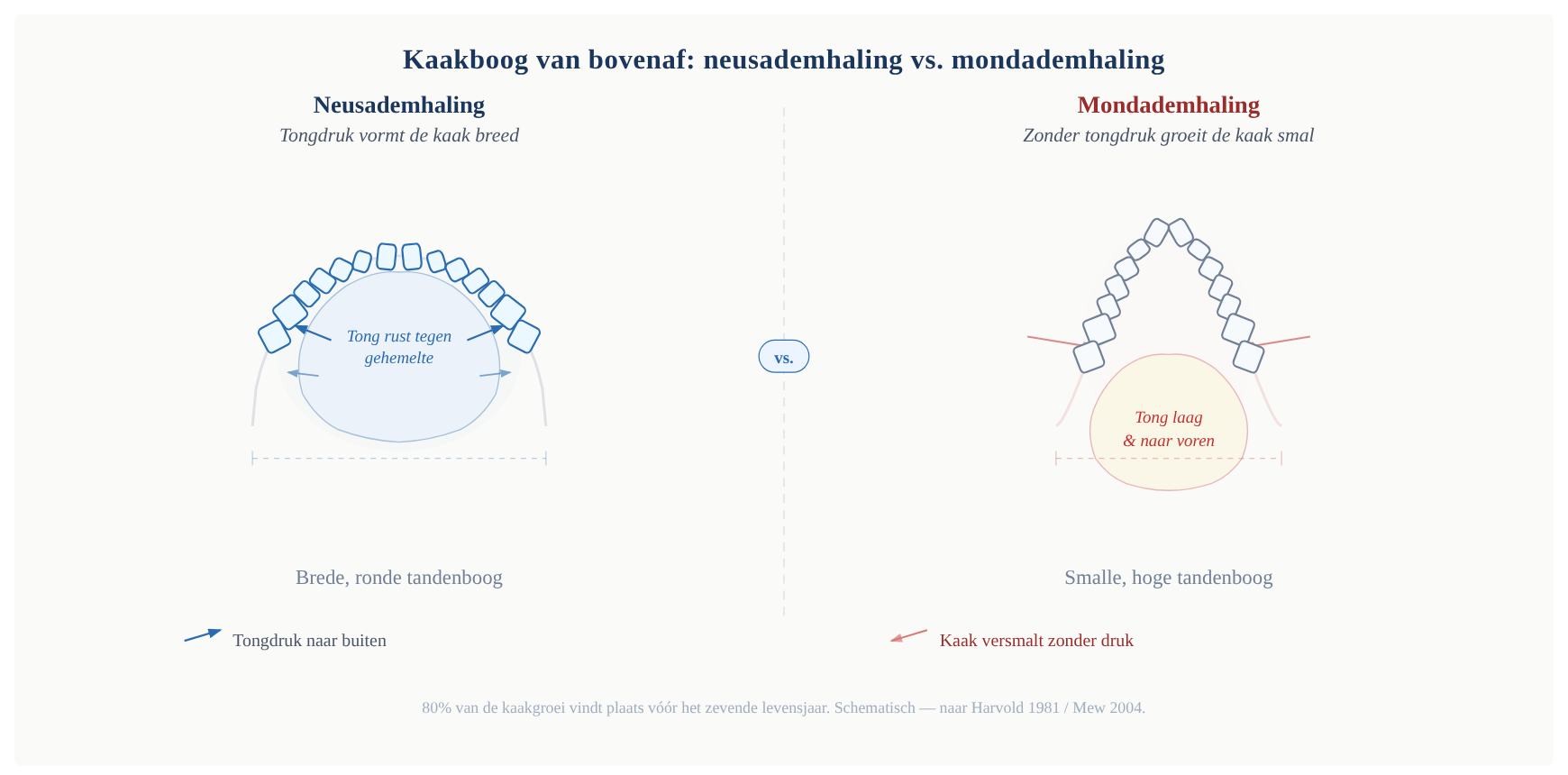 Kaakgroei bij neusademhaling vs. mondademhaling